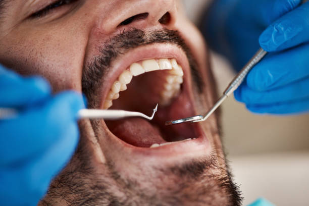 Best Broken Tooth Emergency  in Tiffin, IA