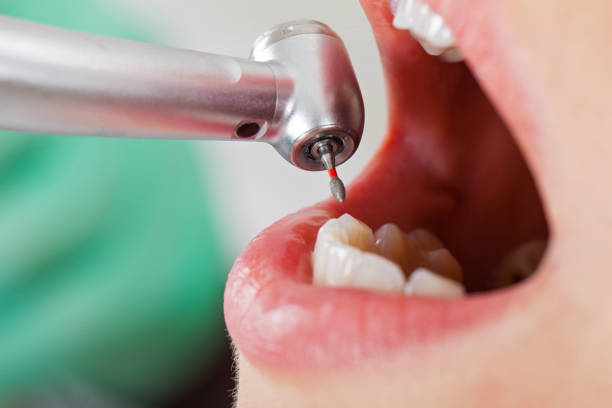 Best Urgent Tooth Repair  in Tiffin, IA
